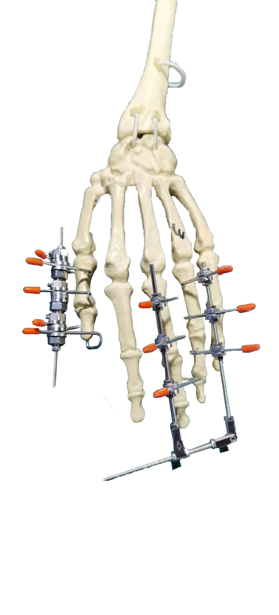 指掌骨构型 (5).png
